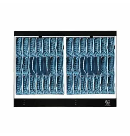 نگاتوسکوپ پزشکی تک خانه سویچ مد مدل SM100