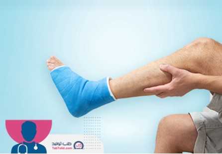آتل آماده یا آتل سفارشی؟