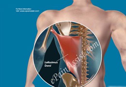 نحوه ی مراقبت از عضلات در مقابل اسپاسم و خستگی