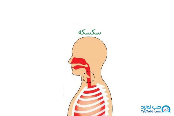 علت سکسکه چیست و آیا سکسکه مداوم خطرناک است؟