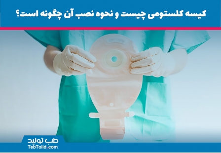 کیسه کلستومی چیست و نحوه نصب آن چگونه است؟